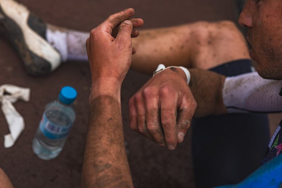 Hands after the cobbles